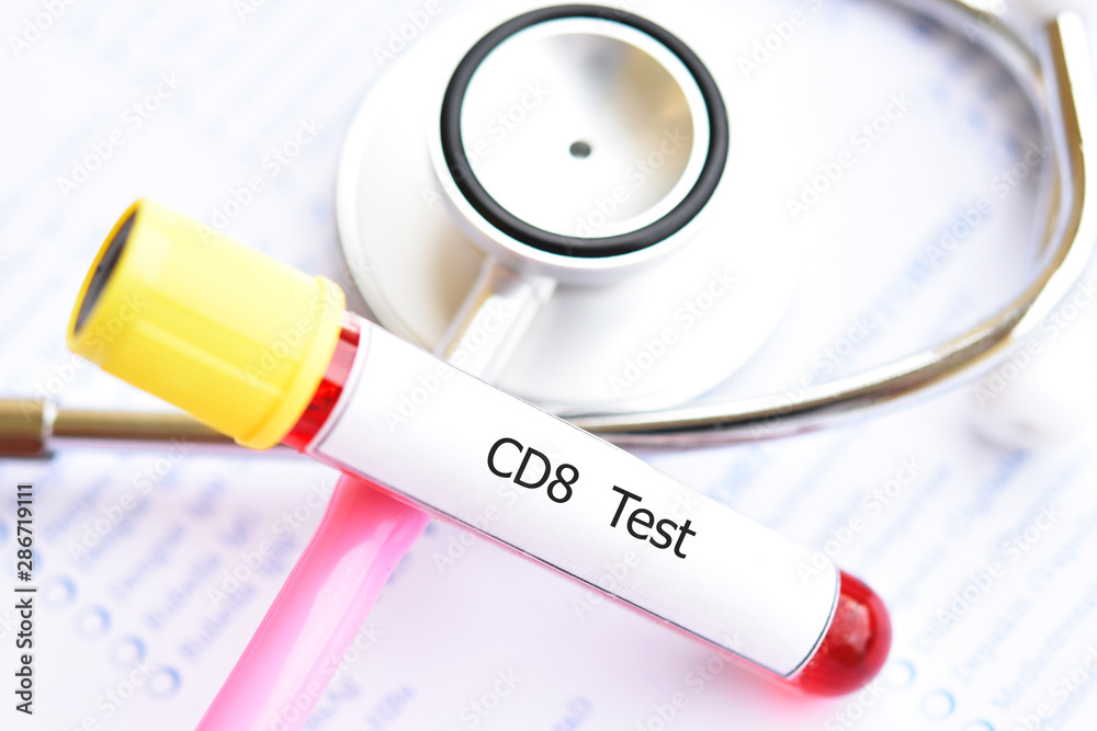 Blood sample tube for cytotoxic T cell lymphocyte or CD8 test Stock ...