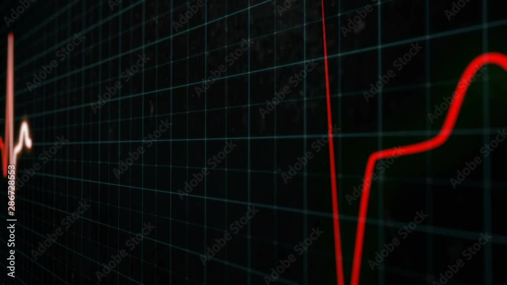 Red heartbeat line with white core. Seamlessly loop animation, EKG ECG screen in close-up. Heart rate monitor electrocardiogram medical monitor. Graph of heart rhythm on grid background. Red heartbeat line with white core. Seamlessly loop animation, EKG ECG screen in close-up. Heart rate monitor electrocardiogram medical monitor. Graph of heart rhythm on grid background.