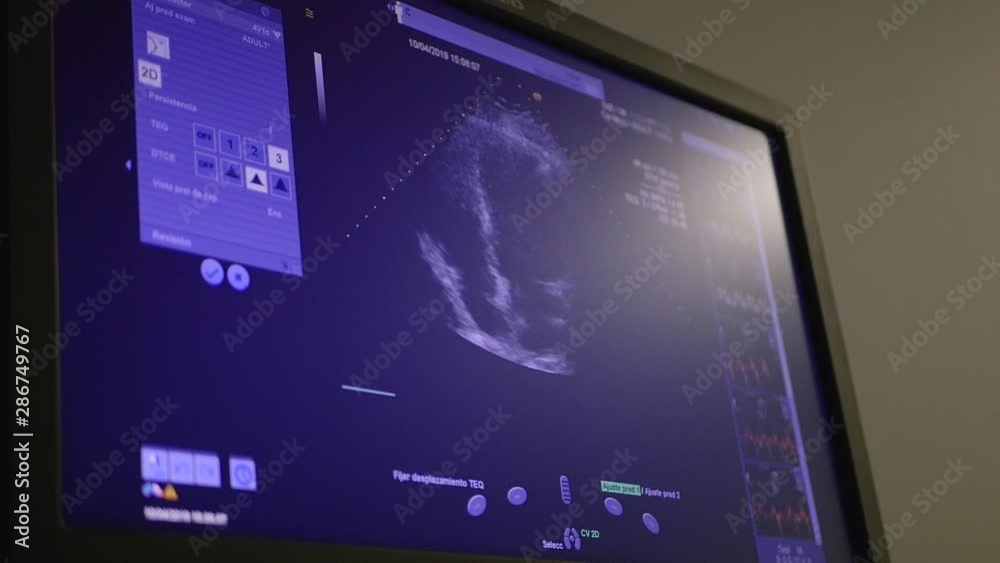 Equipamiento de diagnóstico y pruebas médicas Equipamiento de diagnóstico y pruebas médicas