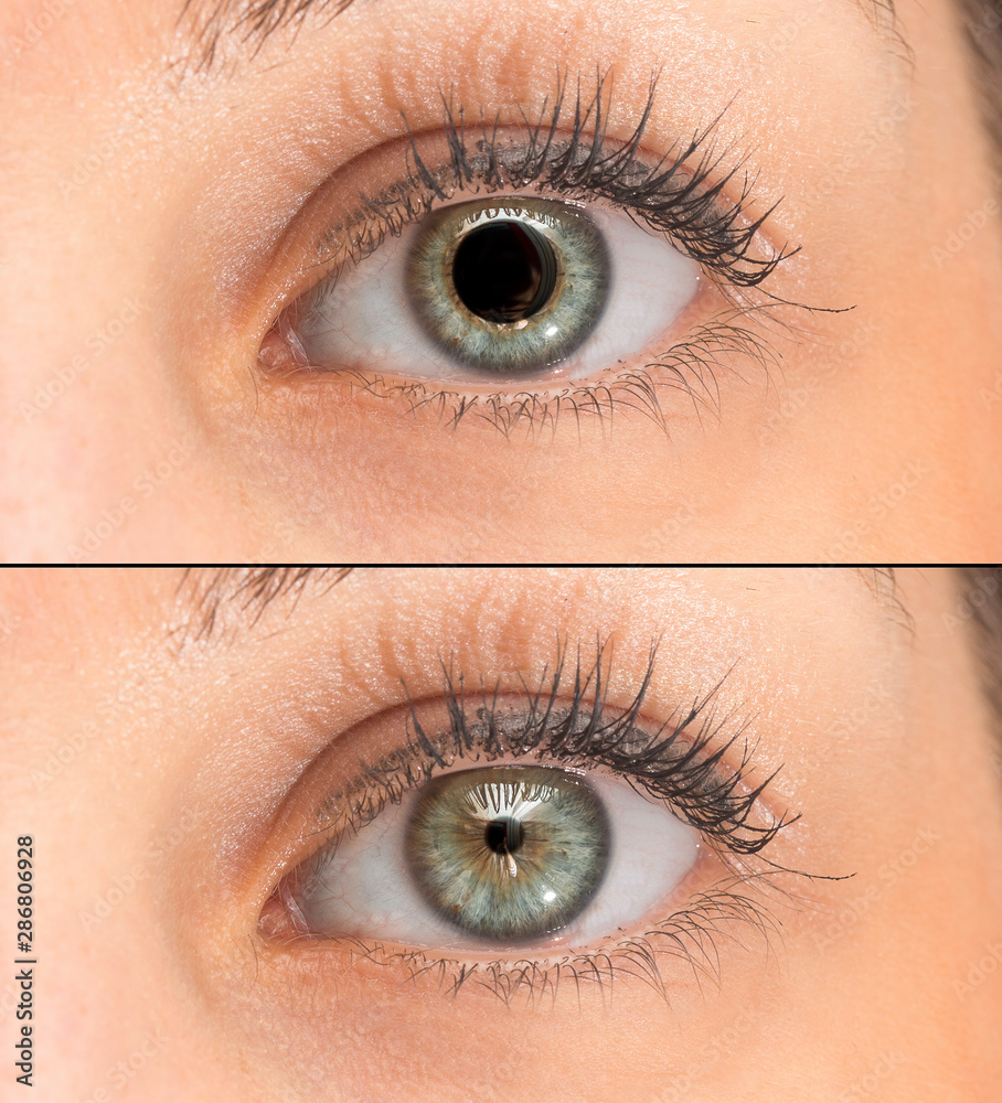 A closeup view on green eyes of a pretty young girl. Collage comparing the  black pupil,