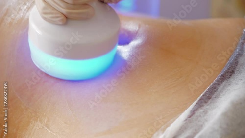 Hardware cosmetology. Body care. Spa treatment. Ultrasound cavitation body contouring treatment. Woman getting anti-cellulite and anti-fat therapy in beauty salon.