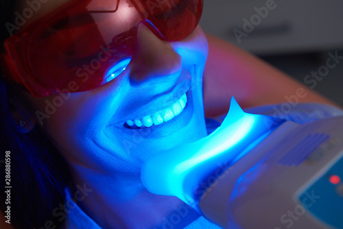 Adult woman is doing teeth whitening procedure photo