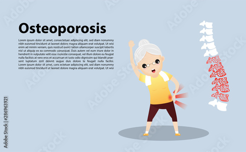 Old woman with osteoporosis. vector,  illustration.