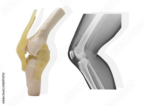 Artificial human knee joint model with Medical x-ray knee normal joint on white background,Medicai concept.