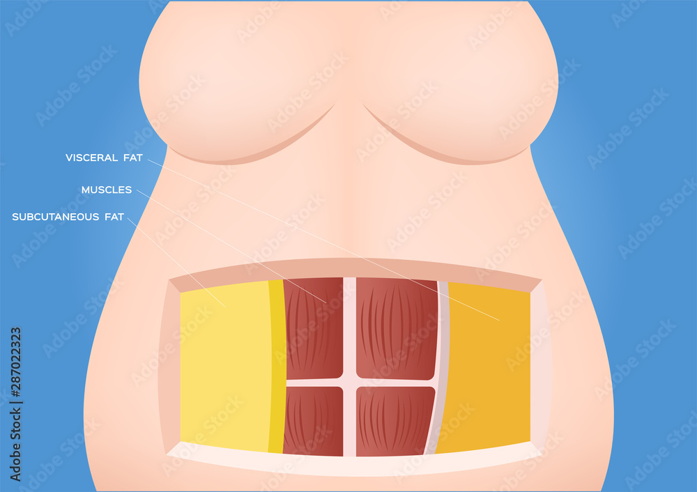 human belly and abdomen fat layer vector / subcutaneous and visceral ...