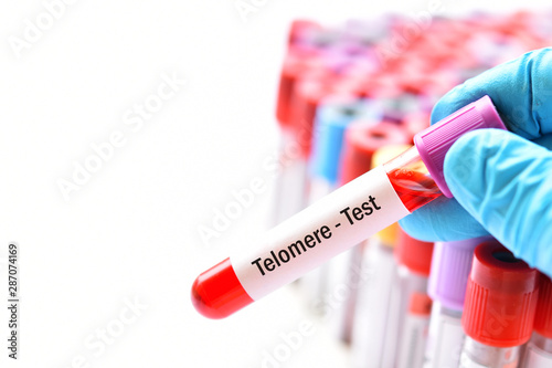 Test tube with blood sample for telomere test, anti-aging prognosis photo