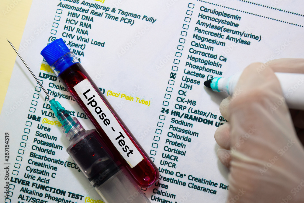 Lipase Test with blood sample. Top view isolated on office desk