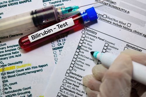 Bilirubin - Test with blood sample. Top view isolated on office desk. Healthcare/Medical concept