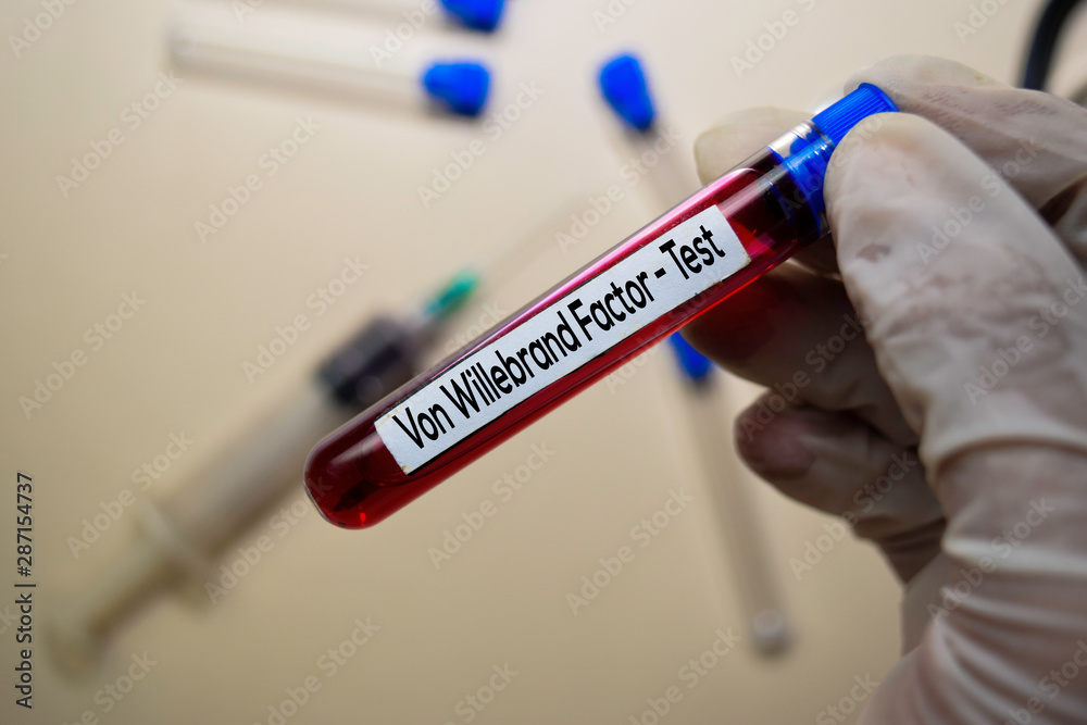 Obraz premium Von Willebrand Factor - Test with blood sample. Top view isolated on office desk. Healthcare/Medical concept