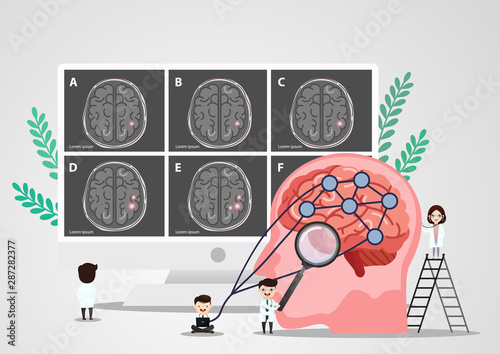 Scientific medical illustration of human brain stroke illustration