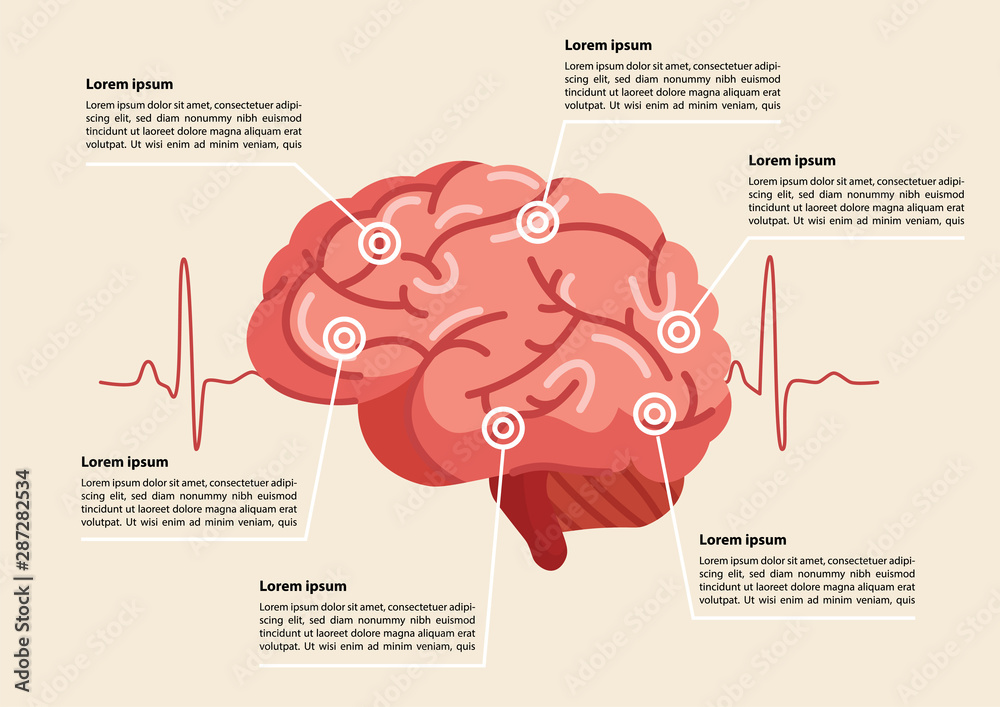 Human brain stroke illustration.