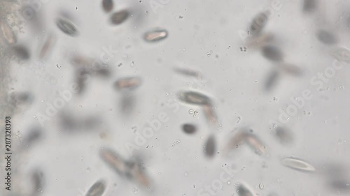 Paramecium caudatum is a genus of unicellular ciliated protozoan and Bacterium under the microscope. photo