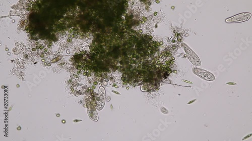 Paramecium caudatum is a genus of unicellular ciliated protozoan and Bacterium under the microscope. photo