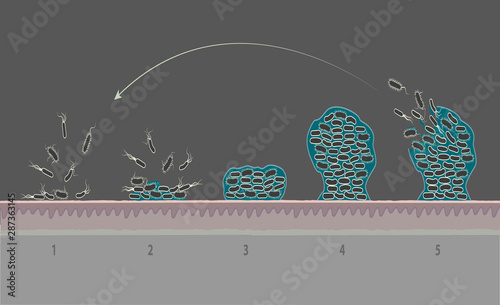 Biofilm