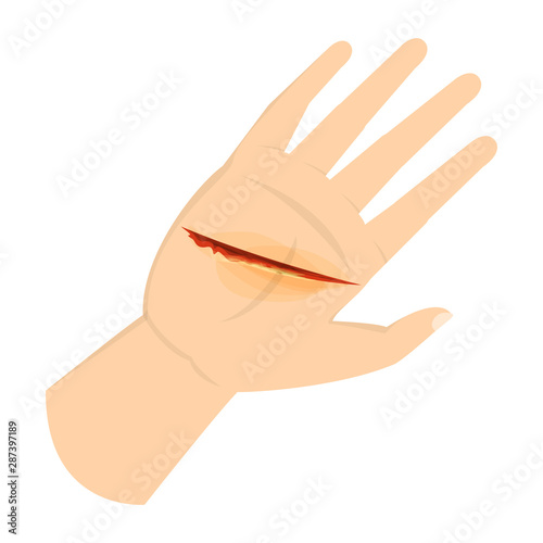 Wound on the hand palm. Red blood, infection