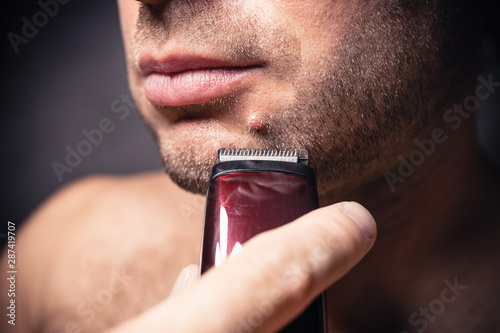 A large mole on the chin is an obstacle to shaving - the danger of damaging the mole with a razor photo