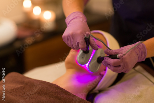 people, beauty, cosmetic treatment, cosmetology and technology concept - close up of beautician with microdermabrasion device doing face exfoliation to woman lying at spa