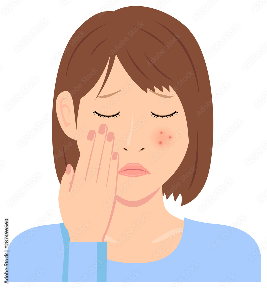 Young woman vector illustration (upper body) / acne, pimple, treckles, rash 