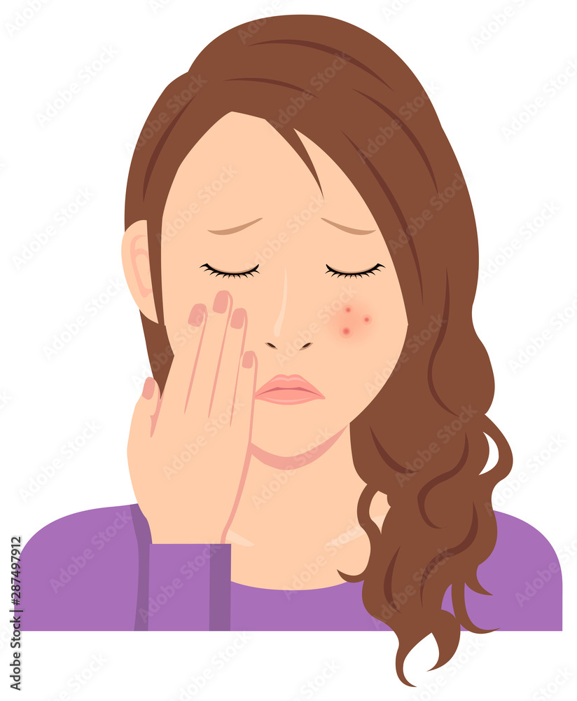 Young woman vector illustration (upper body) / acne, pimple, treckles, rash Young woman vector illustration (upper body) / acne, pimple, treckles, rash