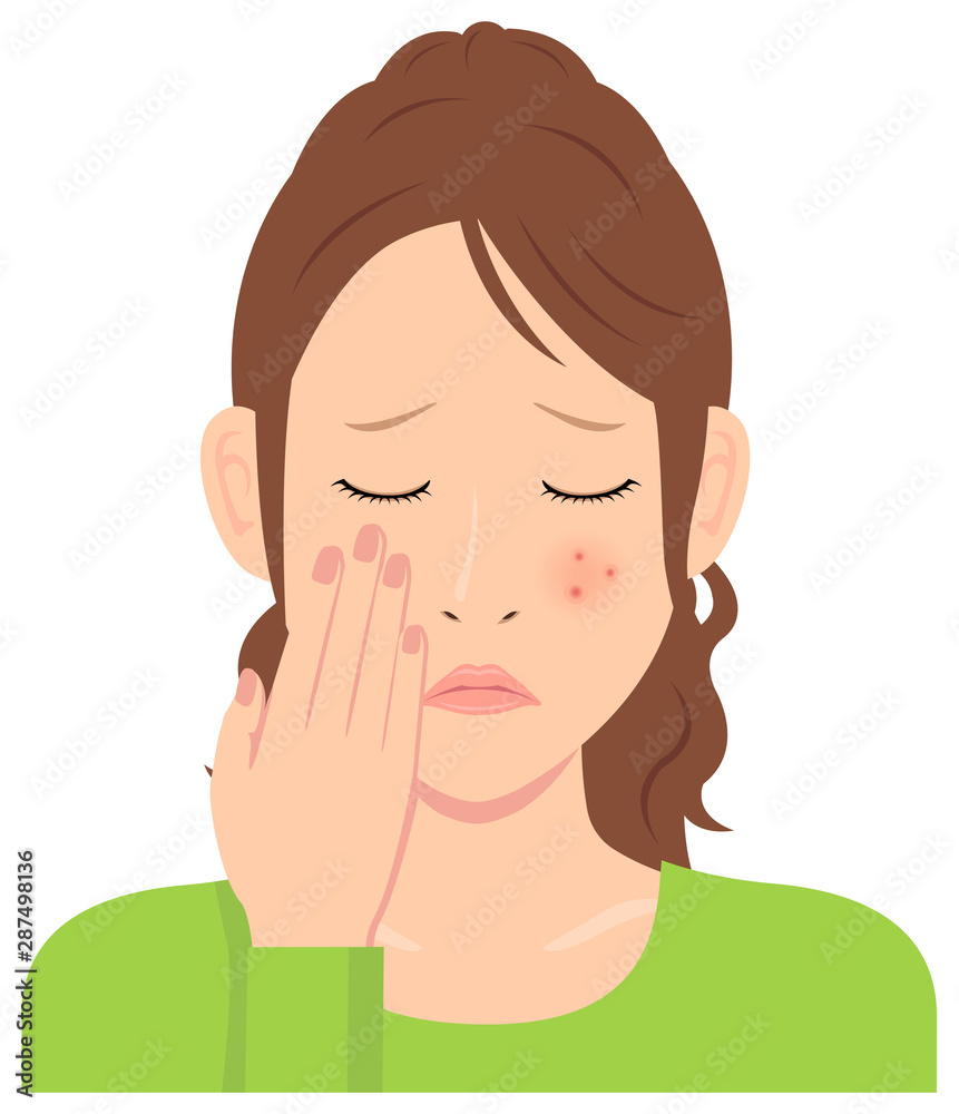 Young woman vector illustration (upper body) / acne, pimple, treckles, rash Young woman vector illustration (upper body) / acne, pimple, treckles, rash