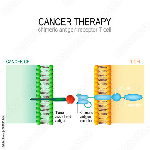 Cancer therapy. CAR T immunotherapy.