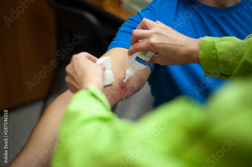 Sports injury. First aid A wound on the arm. A bruise is treated with ointment. Sore hand. The muscles are damaged.