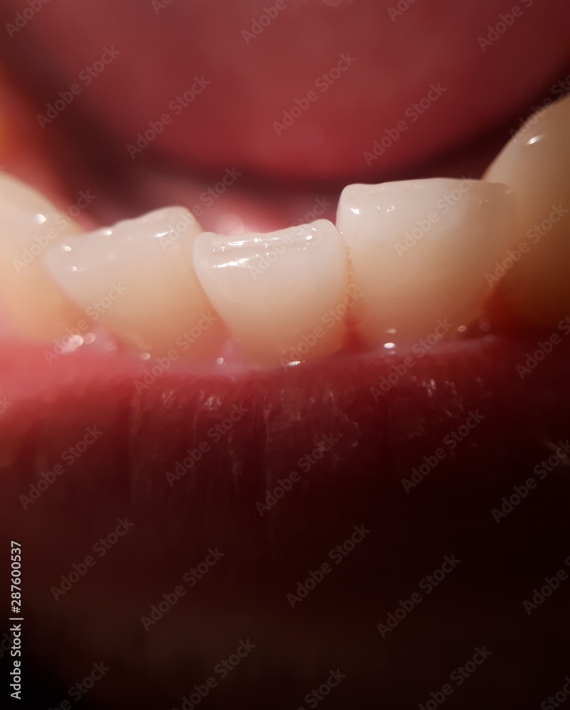 Curved teeth in a man's mouth. Macro