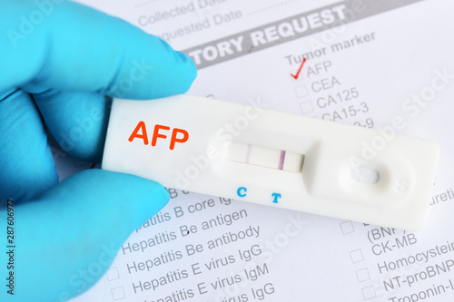 AFP positive test result by using rapid test cassette, liver cancer diagnosis photo