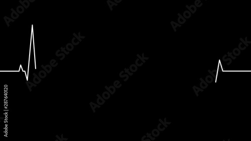 Heart beat cardiogram animation. Heart monitor EKG electrocardiogram pulse seamless loop background.