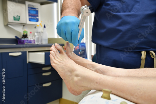 Podiatrist Foot Fungus Bunion