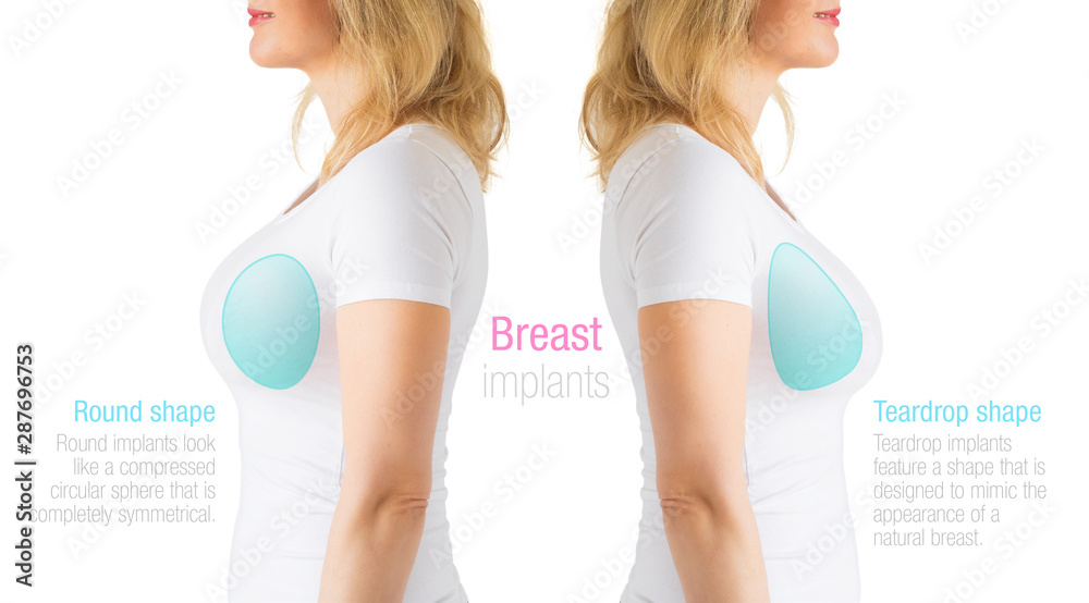 Image showing differences between round and teardrop shaped breast implants  Stock Photo