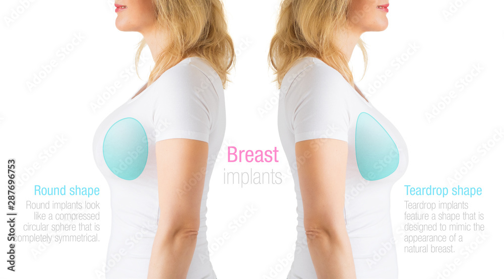 Image showing differences between round and teardrop shaped breast