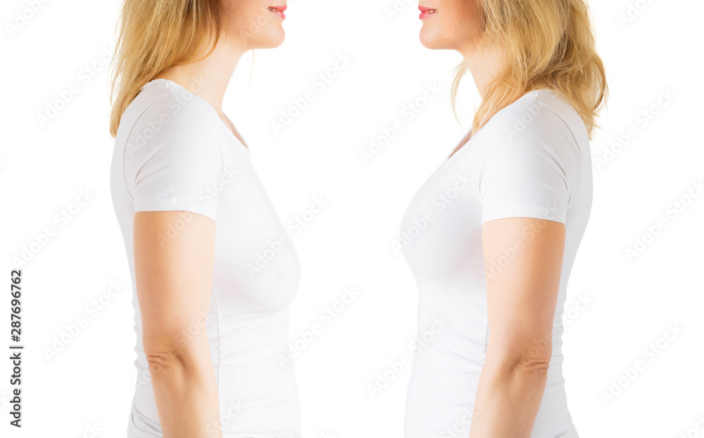 Woman before and after breast lift enhancement plastic surgery Woman before and after breast lift enhancement plastic surgery