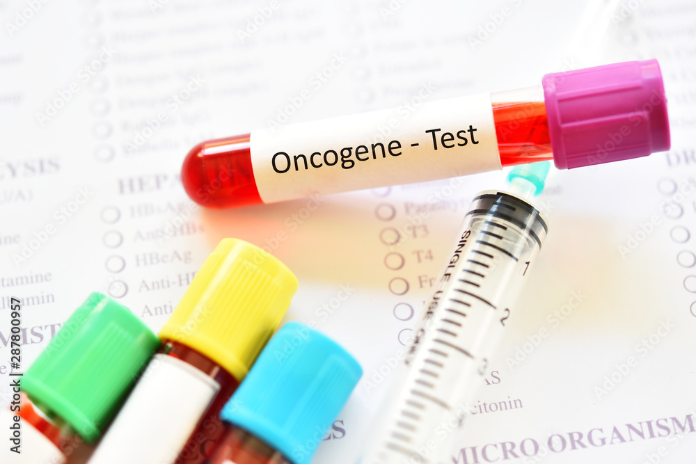Blood sample tube for oncogene test, cancer gene detection Blood sample tube for oncogene test, cancer gene detection