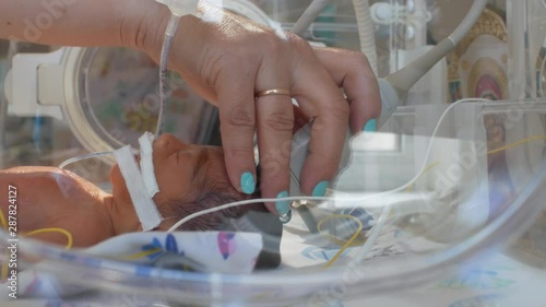 The doctor checks the ultrasound of the head in a premature newborn with a special apparatus in the intensive care unit. 4k. 4k video