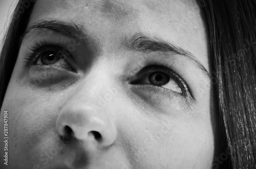 Sad eyes close-up black and white photo, womans eyes with red capillaries and wrinkles on a white background