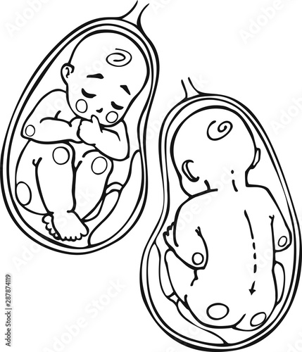 Fetus vector icon, prenatal human child with placenta silhouette isolated on white background. Picture of baby and placenta inside the womb.Simple element illustration. Pregnancy symbol design.