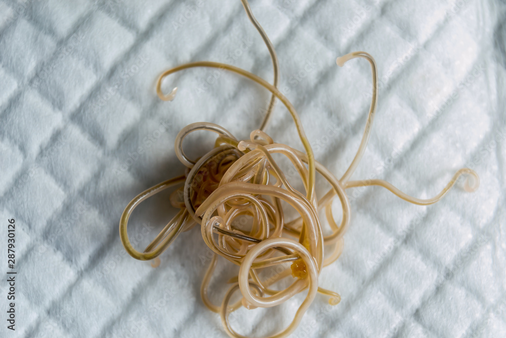Close-up photo of Toxocara cati. Roundworms from a cat Close-up photo of Toxocara cati. Roundworms from a cat