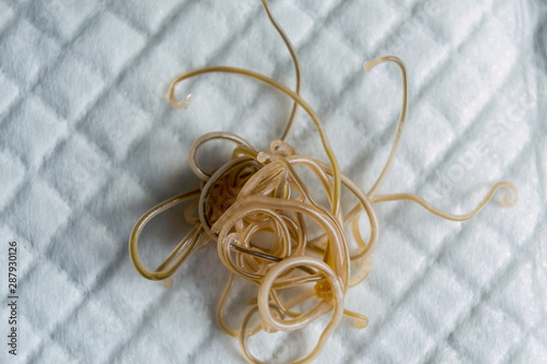 Close-up photo of Toxocara cati. Roundworms from a cat photo