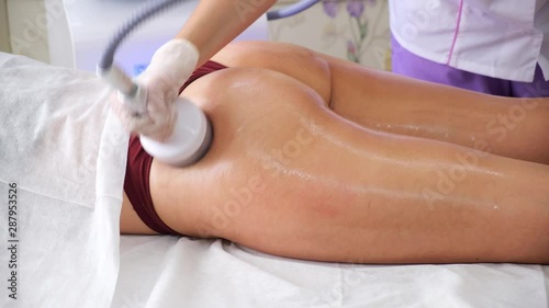 Body treatment: woman getting rf lifting procedure to her buttocks. Perfect shape buttocks on anti-cellulite treatment. vacuum massage the buttocks