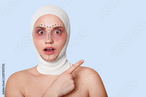Studio shot of beautiful woman before plastic surgery with bandage on head with shocked facial expression, points fore finger to copy space for advertisment or promotion. Cosmetics surgery concept. photo