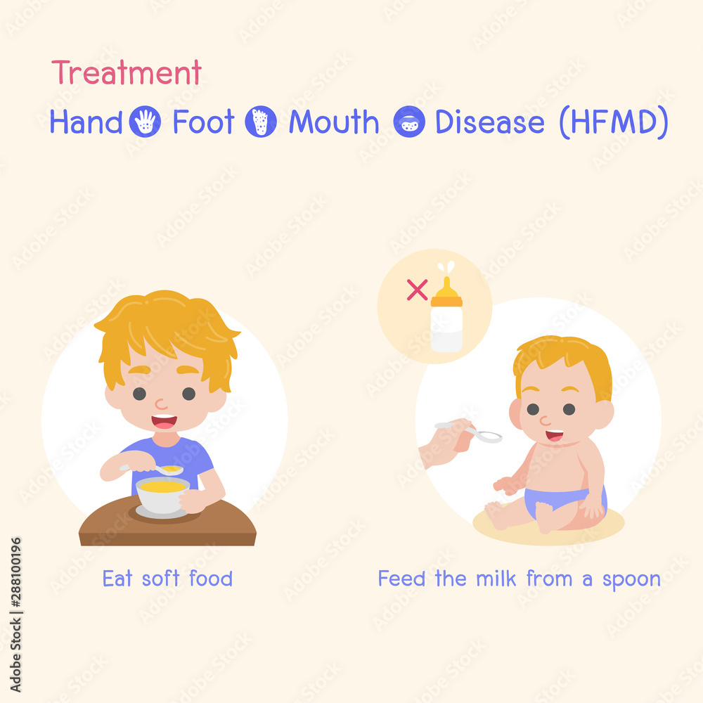 Treatment, Children infected and health, Baby and child have a Hand