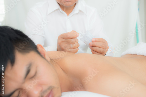 The doctor uses the needle into the body The back of a young man on acupuncture, Chinese acupuncture and alternative medicine