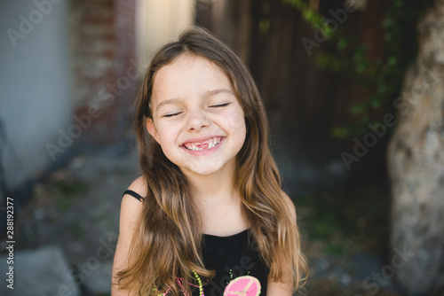 A candid portrait of a girl missing her teeth photo