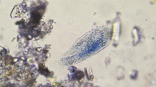 Paramecium colored with methylene blue dye photo