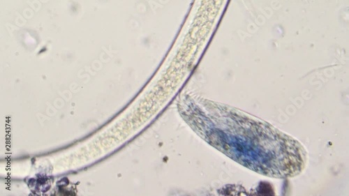 Caenorhabditis and paramecium at microscope photo