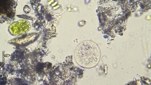 Spherical planktonic microorganism swimming in water photo