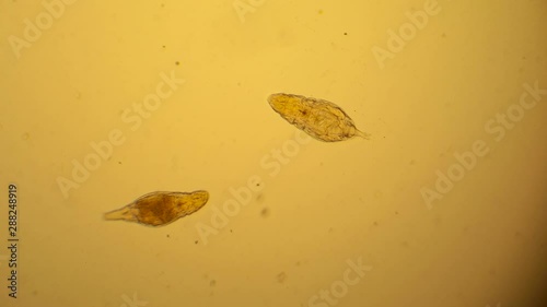 Thiny worms mouving under microscope photo