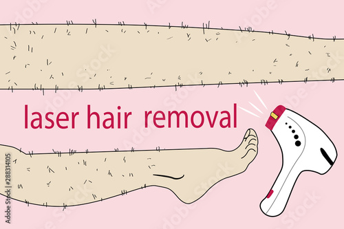 Sketch drawn in vector: woman removes hair from hairy legs with laser hair removal, shaving, waxing, shugaring on an isolated background