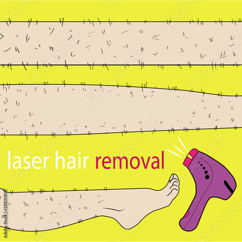 Sketch drawn in vector: woman removes hair from hairy legs with laser hair removal, shaving, waxing, shugaring on an isolated background